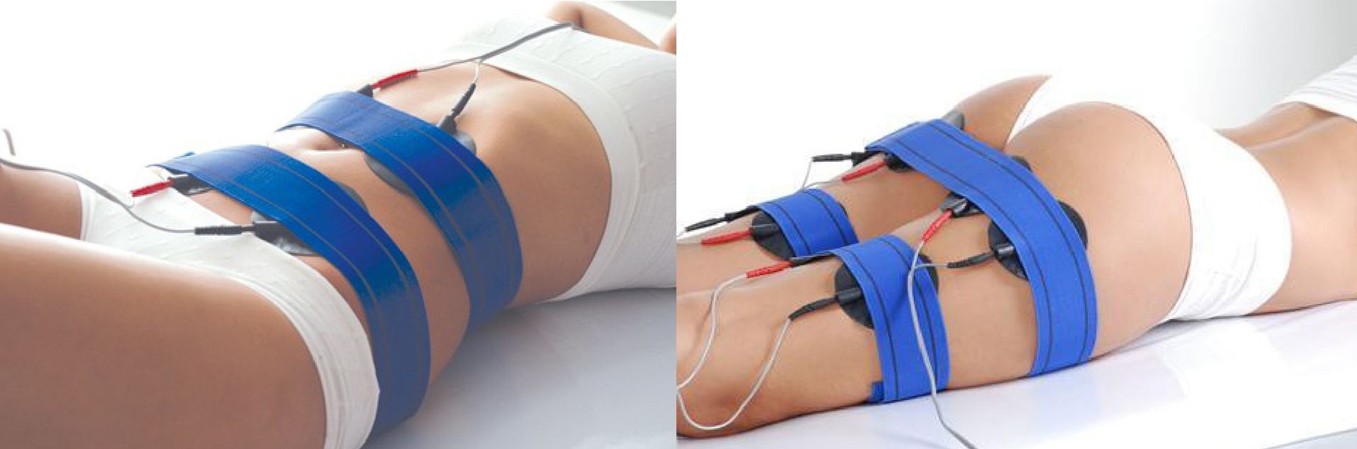 Electroestimulaci&oacute;n corporal