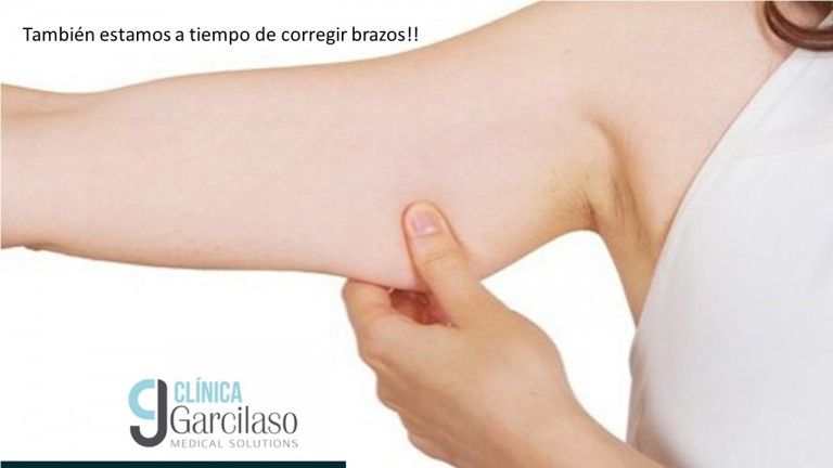 brazos-bodas-768x432