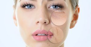 rejuvenecimiento-facial1